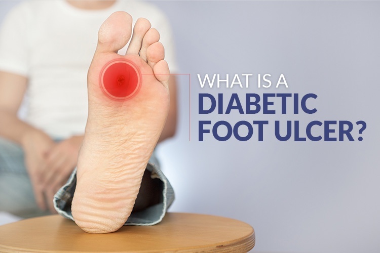 diabetic foot ulcer amputation
