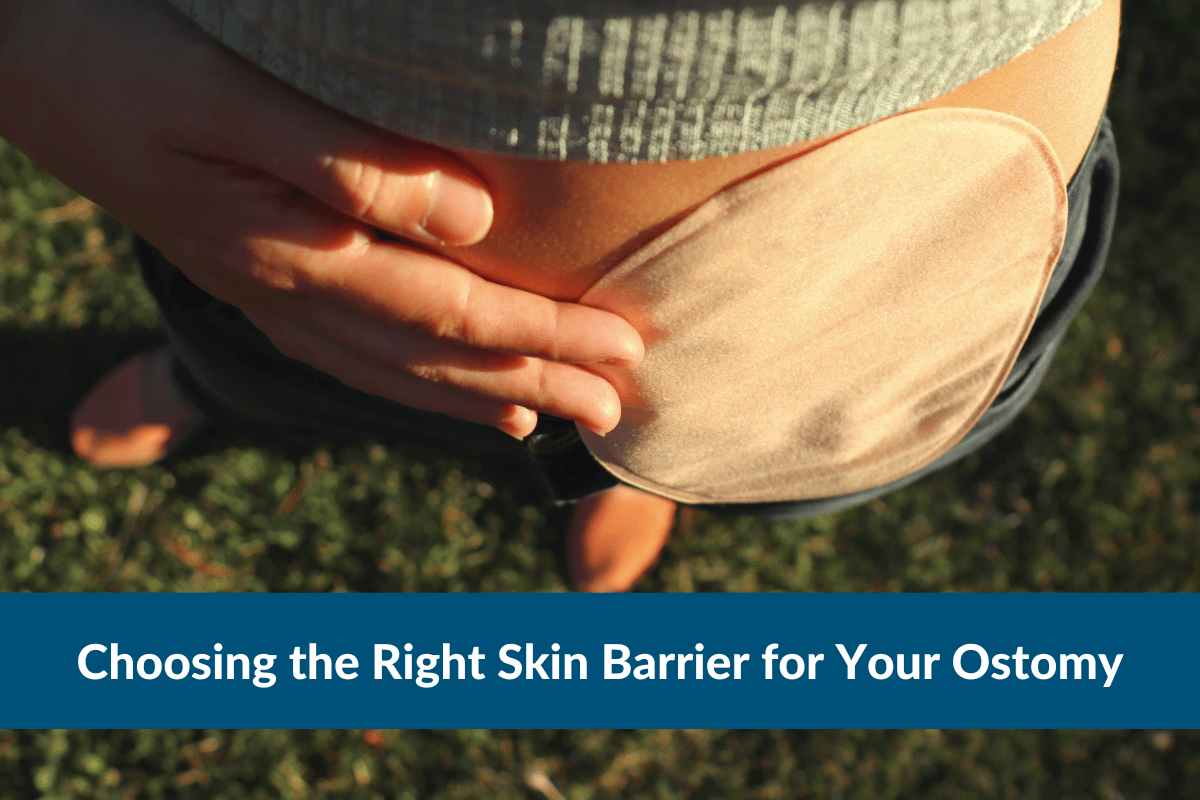 Choosing the Right Skin Barrier for Your Ostomy